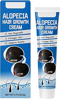Alopecia Hair Growth Cream &ndash; Herbal Scalp Care for Solid Hair Roots, Promoting Regrowth and Fuller Hair?
